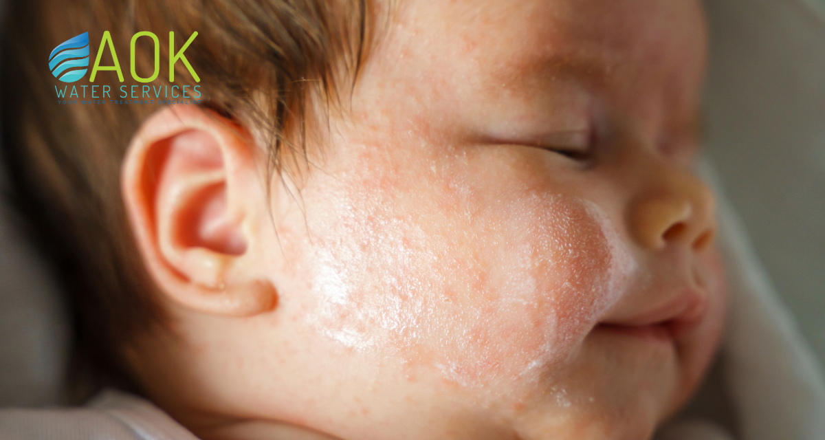 Tired of Buying Creams for Dry Skin? Fix the Water First.