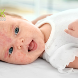 baby eczema Largo FL, eczema flare ups Largo, infant dry skin Largo, hard water skin irritation Largo, baby bath water Largo FL, Largo pediatric dermatology, water softener for baby skin, Largo FL water quality, hard water baby eczema, sensitive skin Largo babies, Largo eczema solutions, best water softener Largo, Largo parenting water issues, itchy baby skin Largo, water softener Largo FL reviews